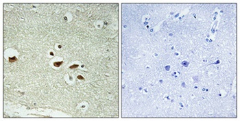 hnRNP K (phospho-Ser284) antibody