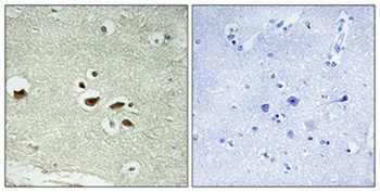 hnRNP K (phospho Ser284) rabbit pAb