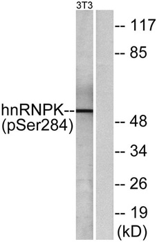 hnRNP K (phospho Ser284) rabbit pAb