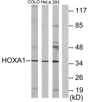 Hox-A1 rabbit pAb Antibody