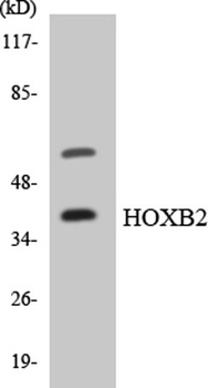 HoxB2 rabbit pAb