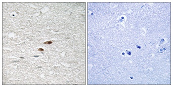APC (phospho Ser2054) rabbit pAb