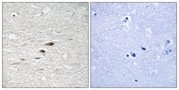 APC (phospho-Ser2054) antibody