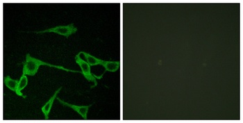Histamine H2 Receptor rabbit pAb