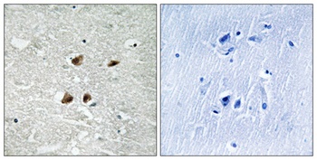 HSF1 (phospho Ser121) rabbit pAb