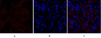 HSP27 antibody