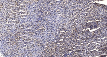 Survivin (phospho Thr34) rabbit pAb