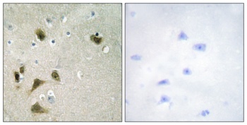 Survivin (phospho Thr117) rabbit pAb