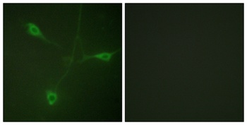 HSP90β (phospho Ser226) rabbit pAb