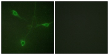 HSP90 beta (phospho-Ser226) antibody