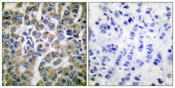 HSP10 antibody