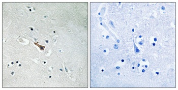 APLP2 (phospho Tyr755) rabbit pAb
