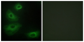 SR-1B rabbit pAb Antibody