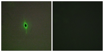 SR-2C antibody