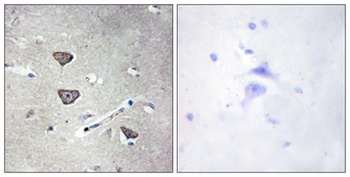 SR-2C antibody