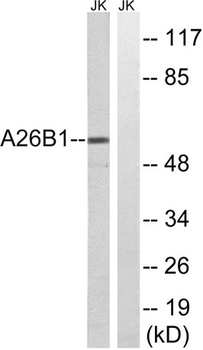POTE15 antibody