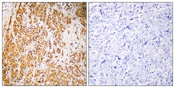 ZSCAN22 antibody