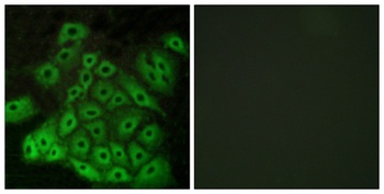 VN2R1P rabbit pAb Antibody