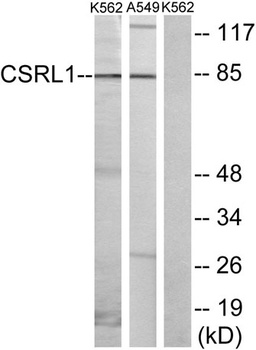 VN2R1P rabbit pAb Antibody