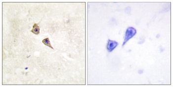 IFN-alpha/beta R alpha (phospho-Tyr466) antibody