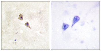 IFN-α/βRα (phospho Tyr466) rabbit pAb
