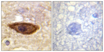 IFN-α/βRα rabbit pAb