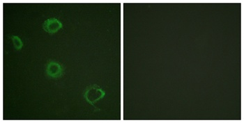 IFN-gamma R alpha (phospho-Tyr457) antibody