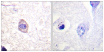 IFN-gamma R alpha (phospho-Tyr457) antibody