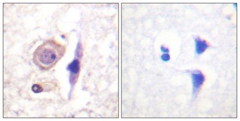 IFN-gamma R alpha antibody