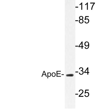 Apolipoprotein E antibody