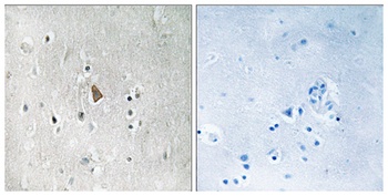 IGF-IR (phospho Tyr1346) rabbit pAb