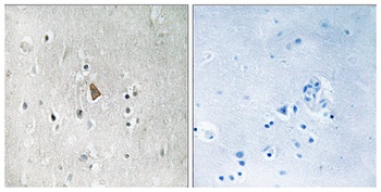 IGF-IR (phospho-Tyr1346) antibody