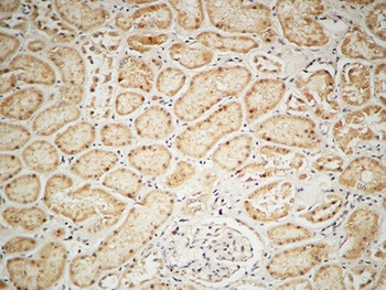 IGF-IR rabbit pAb