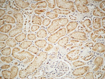 IGF-IR antibody