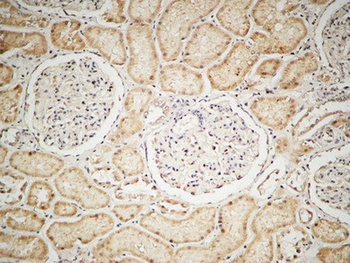 IGF-IR antibody