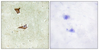 IGF-IIR (phospho-Ser2409) antibody