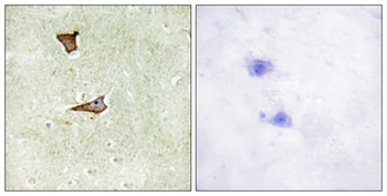 IGF-IIR (phospho Ser2409) rabbit pAb