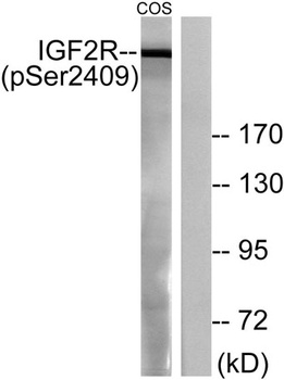 IGF-IIR (phospho Ser2409) rabbit pAb