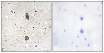 IGFBP3 (phospho Ser183) rabbit pAb