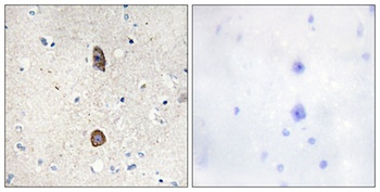 IGFBP3 (phospho-Ser183) antibody