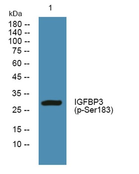 IGFBP3 (phospho-Ser183) antibody