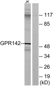 GPR142 antibody