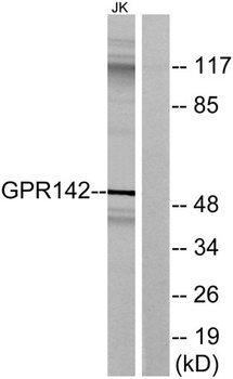 GPR142 rabbit pAb