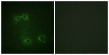 FAS (phospho Tyr291) rabbit pAb