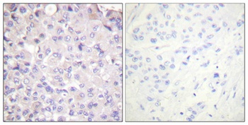 IKKβ (phospho Tyr188) rabbit pAb Antibody