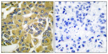 IKKβ (phospho Tyr188) rabbit pAb
