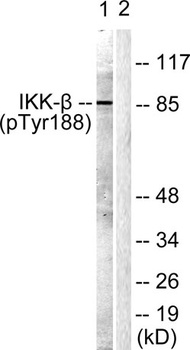 IKK beta (phospho-Tyr188) antibody