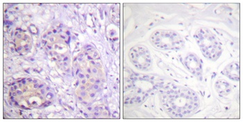 IKKβ (phospho Tyr199) rabbit pAb