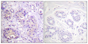 IKK beta (phospho-Tyr199) antibody