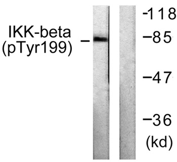 IKK beta (phospho-Tyr199) antibody
